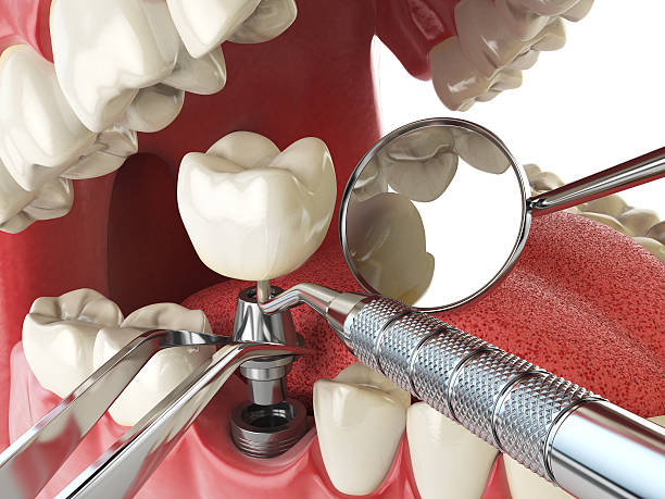 Best Urgent Dental Care for Toothaches in Shawneetown, IL